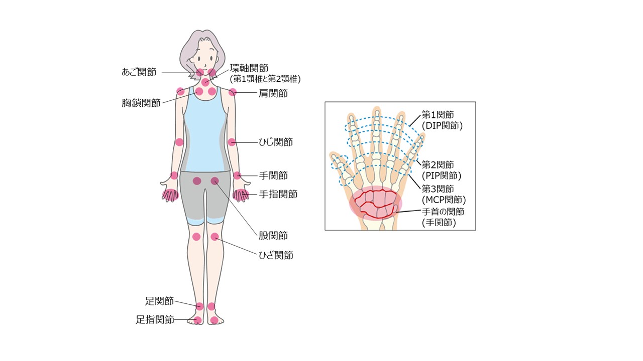 身体の中の関節イラスト図